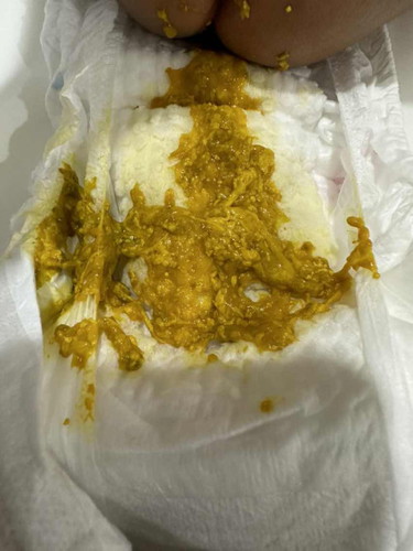 is this normal poop