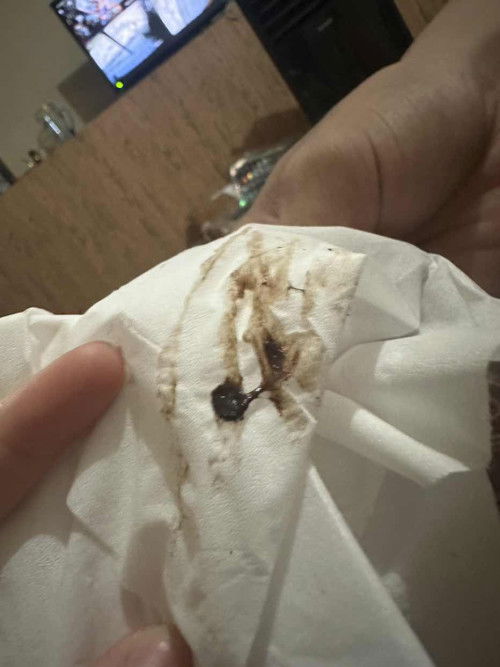 Flek tanda keguguran atau bukan