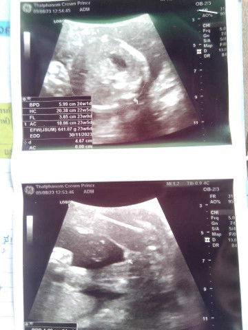 แม่ๆช่วยดูเพศน้องให้หน่อยจ้า