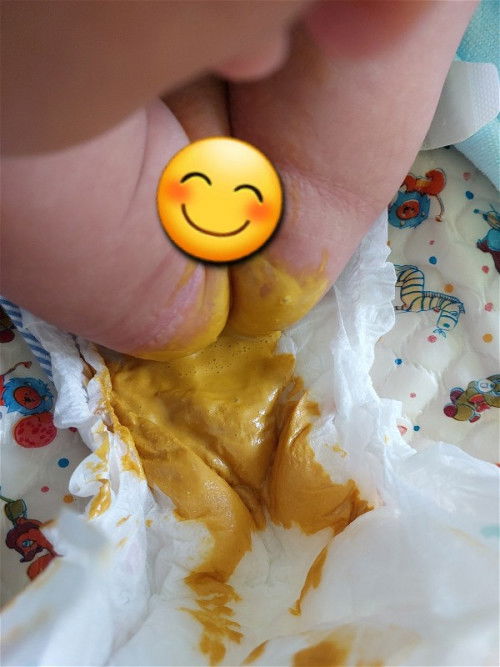 อึเหลวน้ำแบบนี้เป็นปกติทารกนมแม่ล้วนไหมคะ