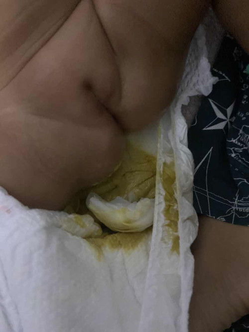 Hello mommy normal ra poba yung tae ka pag na milk  

Sana masagot first time mom