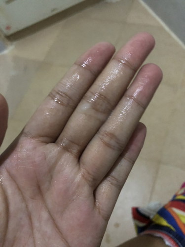 อันนี้คือมูกใช่หรือเปล่าคะ