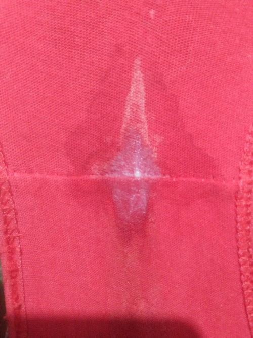 36wks2days white discharge