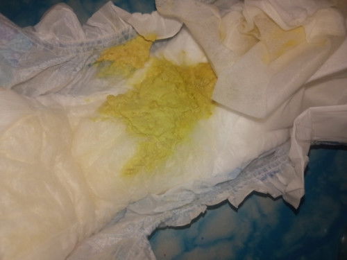 POOP 1MONTH OLD BABY (BONNA USER)