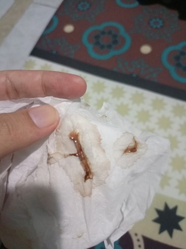 Mau tanya pas malem keluar flek coklat apakah bahaya gk bun