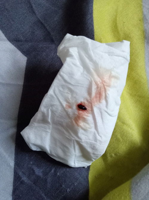 HAMIL 35WEEK KELUAR FLEK