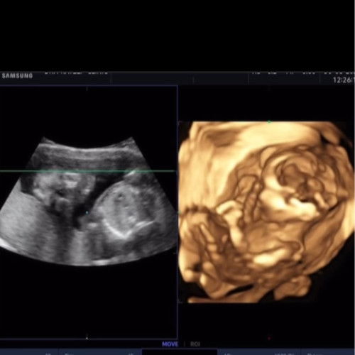 แม่ๆคิดว่าเป็นผู้หญิงหรือผู้ชายคะ