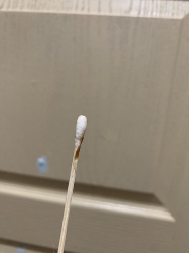 brown discharge aftwr sex