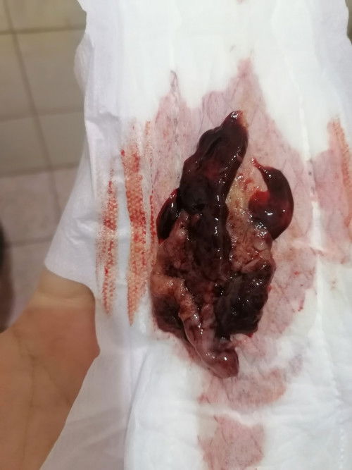 ประจำเดือนผิดปกติใช่ไหม