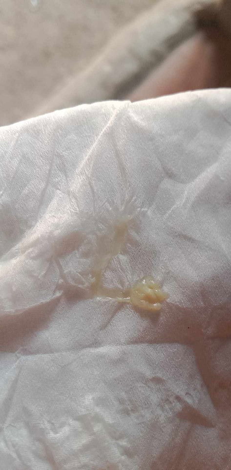 37สัปดาห์วันนี้เพิ่งมีคะปกติเป็นแบบี้ใสๆแต่วันนี้ออกเหลืองๆ