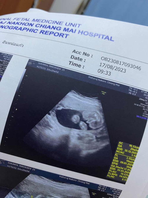 แม่ๆช่วยดูเพศหน่อยค่ะ