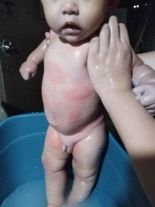 Hellow po. Tanung lang po ako kung sino naka experience nito sa kanilang baby? Kinakabahan po kc ako