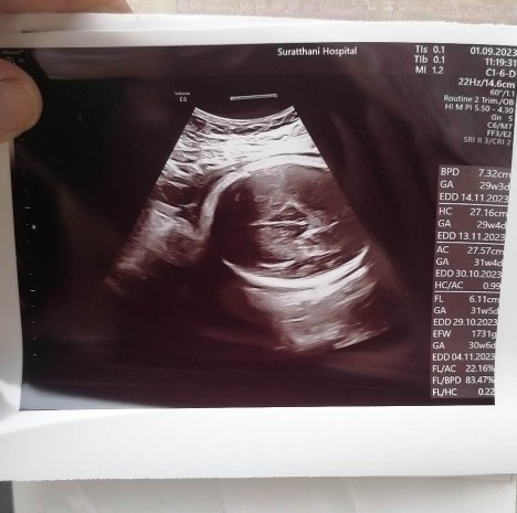 ปรึกษาเรื่องเพศลูก