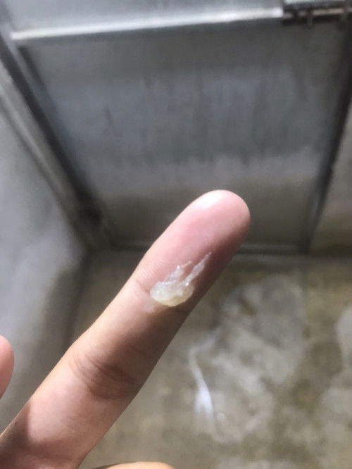 สอบถามแม่ๆใกล้คลอดหน่อยค่ะ