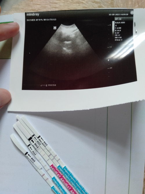 Galau Bun usia 7weeks blm terlihat kantung, apa normal?