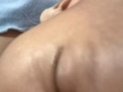 Putih putih dikulit si bayi apa ya bun?