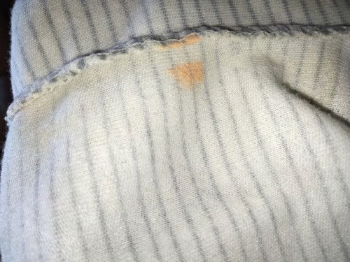 Noda oren dicelana bayi