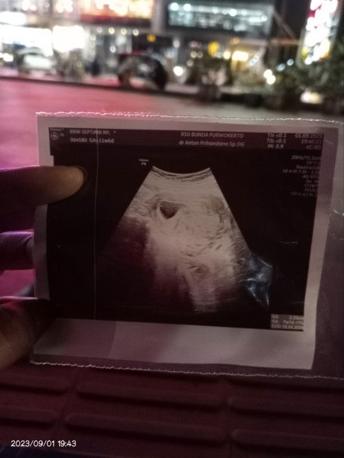 Masih bertanya tanya dan sedikit ovt