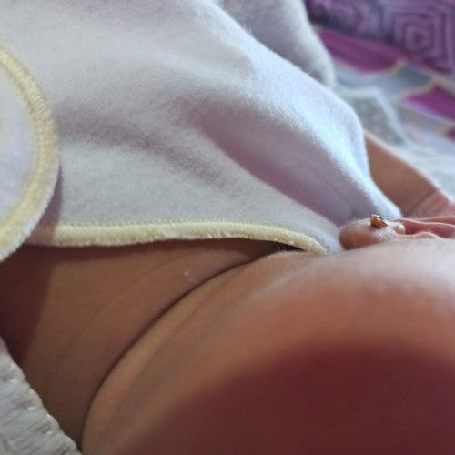 Bintik putih kaya milia di bayi