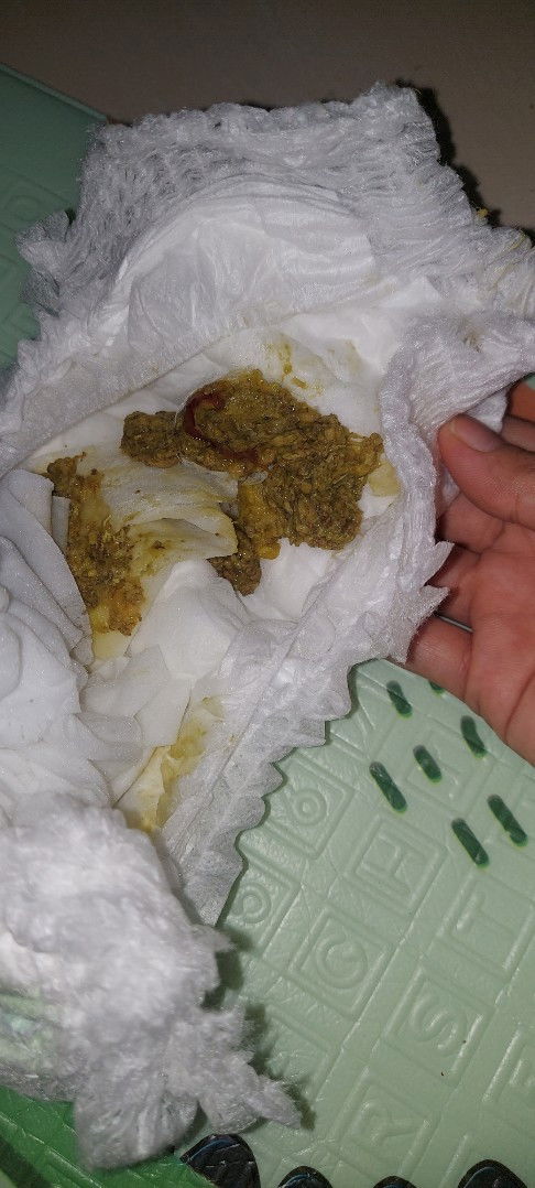 Bab bayi 6bulan berlendir merah