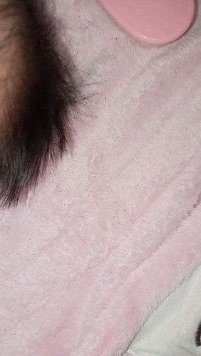 Klo dewasa mah kaya ketombe