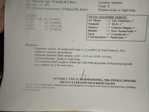 10th- 90th percentile