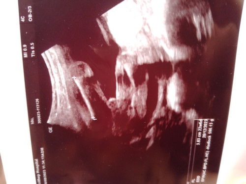 อยากทราบหญิงหรือชาย🥰