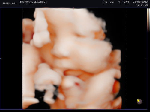 น้ำหนักลูกเท่าไหร่กัน แชร์หน่อยค่ะ