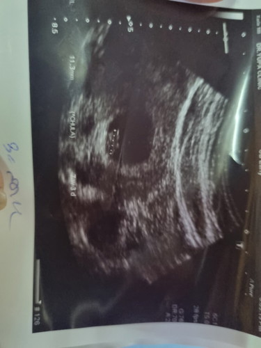 แบบนี้แฝดไหมคะ