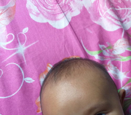 Bintik2 diwajah sama perut kenapa yh bun?