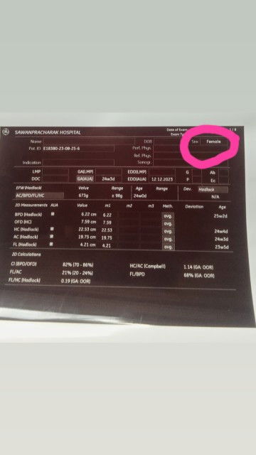 แม่ท่านไหนใบซาวตรงกับเพศลูกบ้างค่ะ