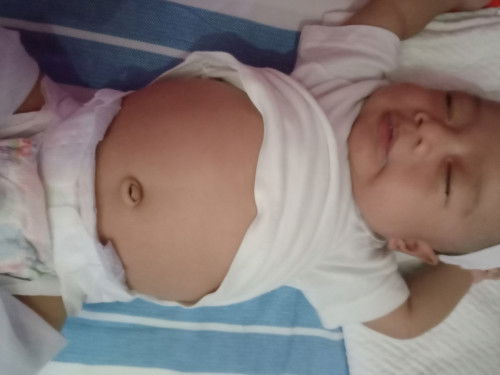 Normal lng ba Ang laki Ng tyan baby ko? Malaki sya pag nakadede 1 month old pLAng sya.