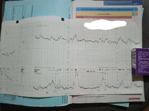 ติดเครื่องNst