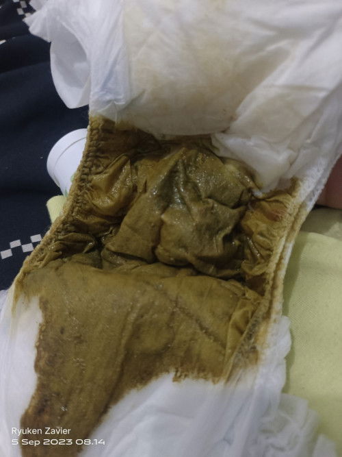 Pup cair di usia 4 bulan