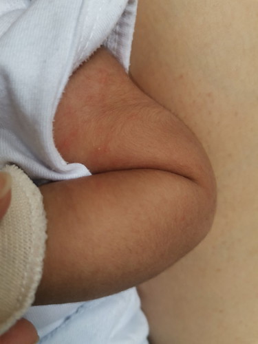 Normal or dengue?
