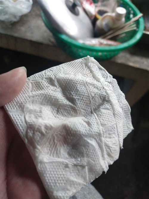 ควรไปหาหมอมั้ยคะ 37+1