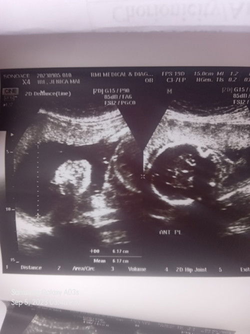 Sa tingin nyo po ano gender sabi kse 50% bbgurl