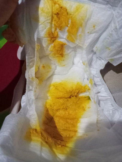 Pup bayi 1bulan 17hari