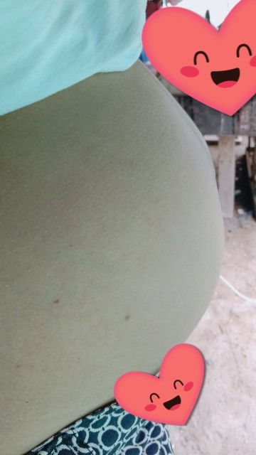 เข้าไตรมาสที่3แล้วคือปวดหลังมากๆ🤣28สัปดาห์7เดือนเต็มอดทนอ่ะเนาะ