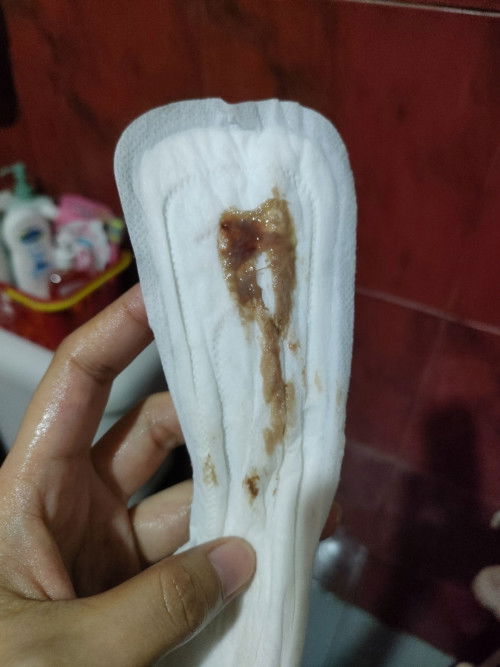 Ito po ba yung mucus plug? EDD ko po ay Sept 9. I'm 39 wks and 4 days na po.