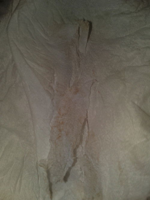 Ini keputihan atau flek ya Bun?