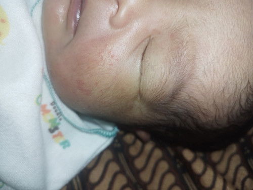 Bantu jawab buat bunda yg sudah pengalaman