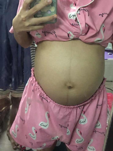โดนคนทักว่าท้องเล็ก