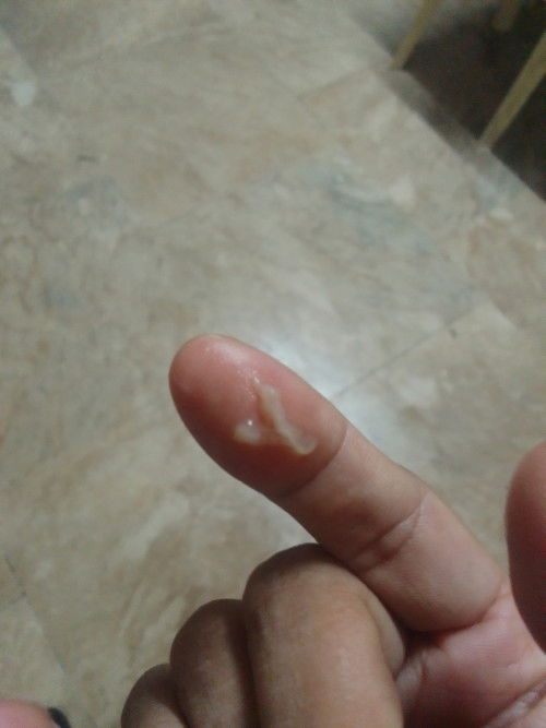 tanong ko lang po kung mucus plug na po ito? 38weeks and 6days na po ako ngayon. 1cm po nung sunday