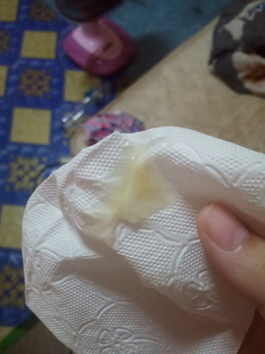 เเบบนี้มูกใสมั้ยคะ