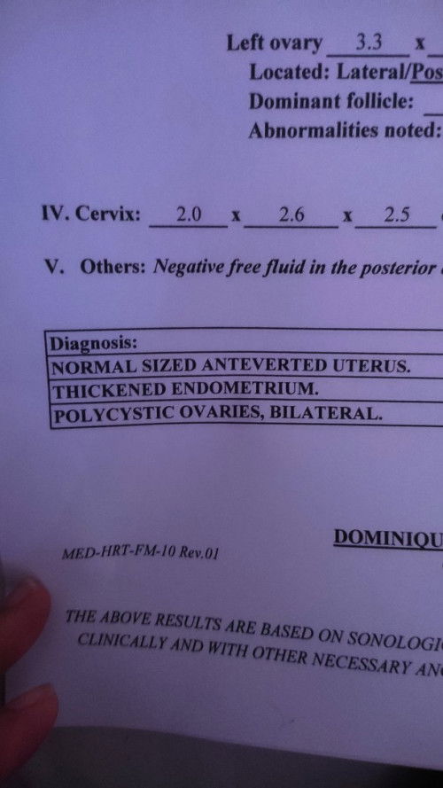 THICKENED ENDOMETRIUM, POLYCYSTIC OVARIES BILATERAL
