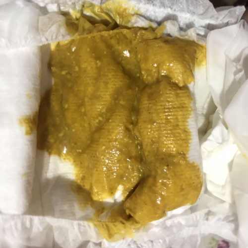 อุจจาระเด็กน้อย💩