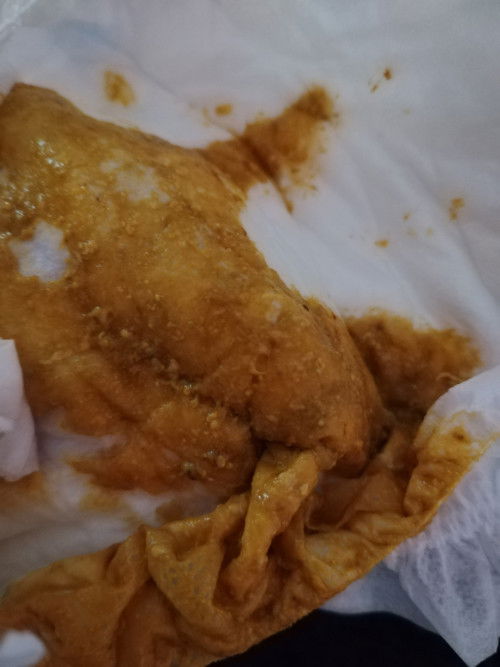 Bayi najis kuning cair lepas 2minggu lebih minum susu fm lactose free.