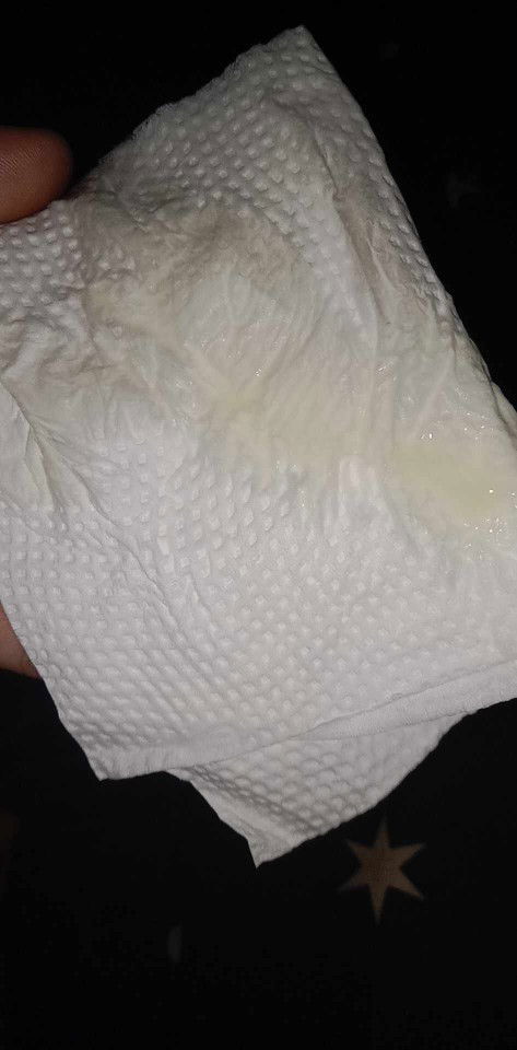 ใช่มูกเลือดรึป่าวคะ