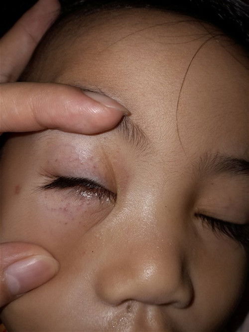 hello po meron po ba dito nakaka alam kung ano itong nasa mata ng baby ko?#advicepls